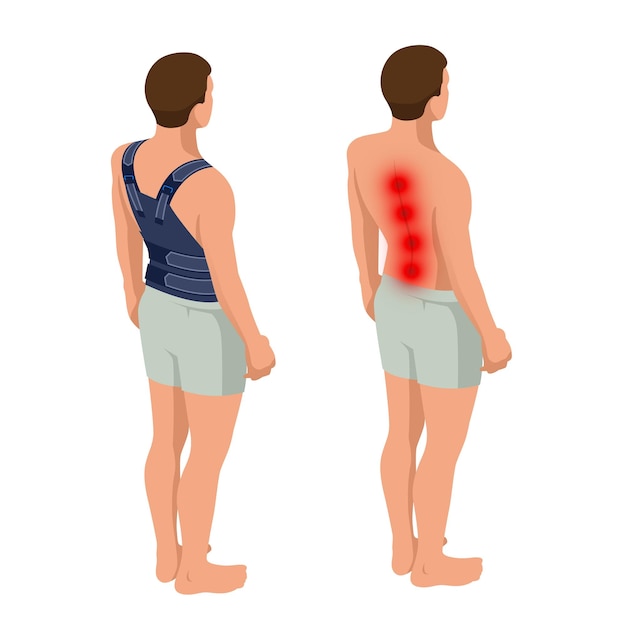 Rückenschmerzen oder Wirbelsäulenschmerzen Osteoporose Anatomischer Körper eines Mannes Rehabilitation nach einem Trauma Orthopädie und Medizin Isometrische Vektordarstellung