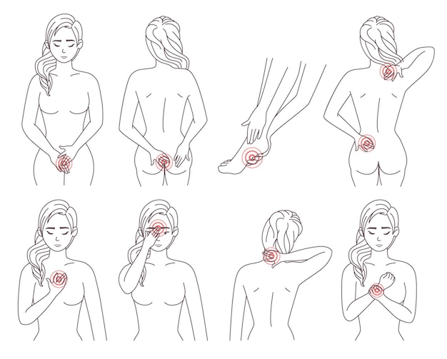 Schmerzzone des weiblichen Körpers, Vektorillustration. Erkrankte Körperteile des Patienten verletzen Bereiche mit roten Schmerzpunkten. Migräne, Kopfschmerzen, Rückenschmerzen, Magen-, Fuß-, Handgelenk-, Schulterschmerzen, Menstruationsschmerzen.