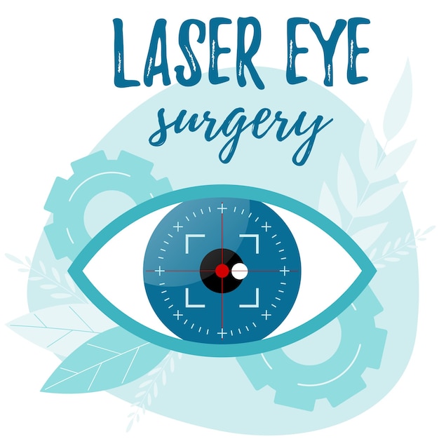 Sehkorrektur durch einen laserstrahl augenchirurgie ophthalmologe vektorgrafik