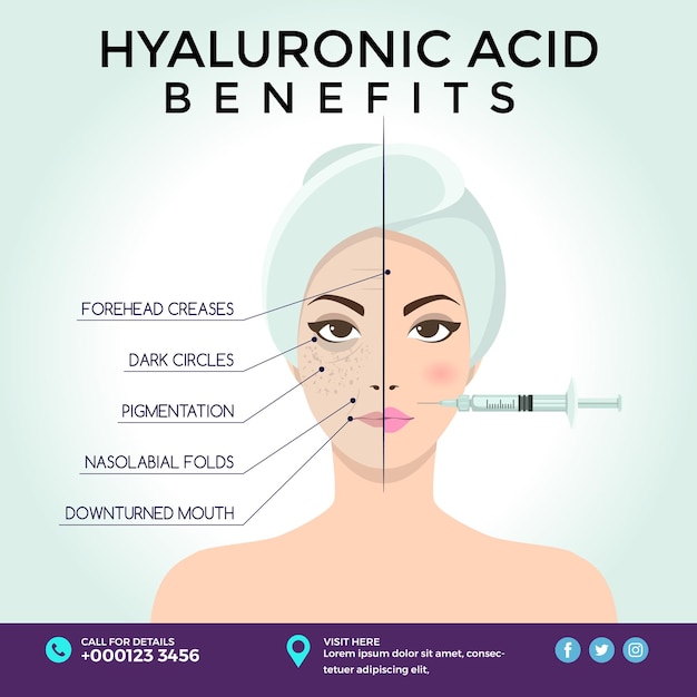 Skin trearment hyaluronsäure benefit botox filler