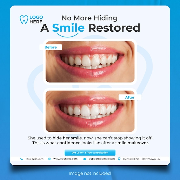 Smile Makeover-Werbung für eine Instagram-Vorlage für eine Zahnklinik