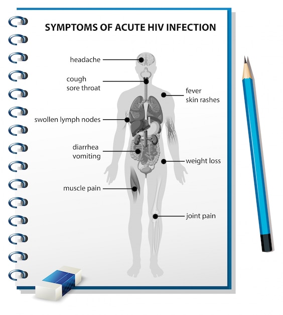 Symptome einer akuten hiv-infektion diagramm