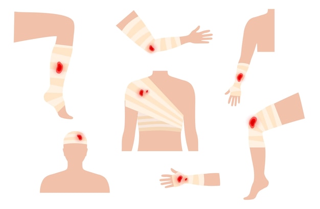 Vektor trauma der menschlichen gliedmaßen