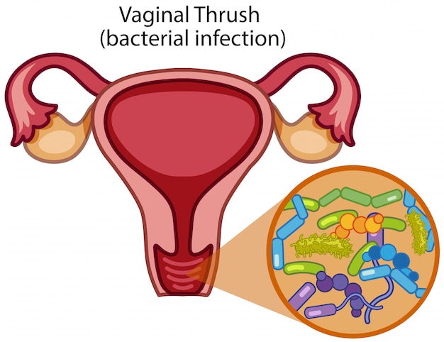 Vaginale drossel auf weißem hintergrund