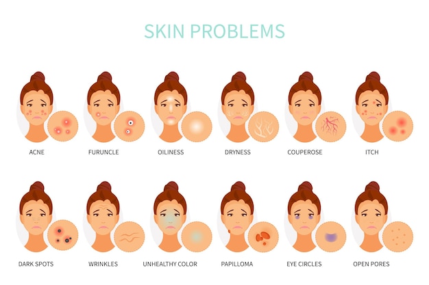 Vektor verschiedene hautprobleme dermatologie und kosmetik