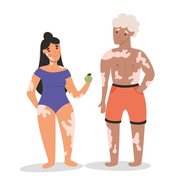 Vektor vitiligo bei einem mann und einem mädchen in badeanzügen. flache vektorillustration. hautkrankheit, körper positiv