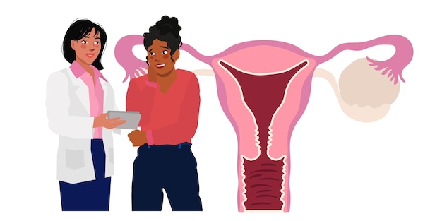 weibliches Fortpflanzungssystem Eierstockkyste obgyn erklären der Patientin Illustration