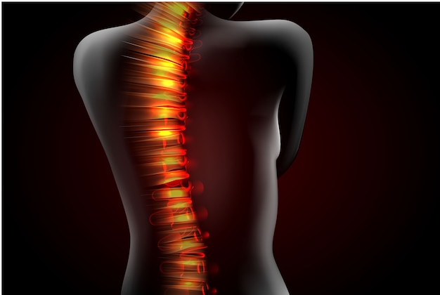 Wirbelsäulenfrauen-illustration medizinisches konzept