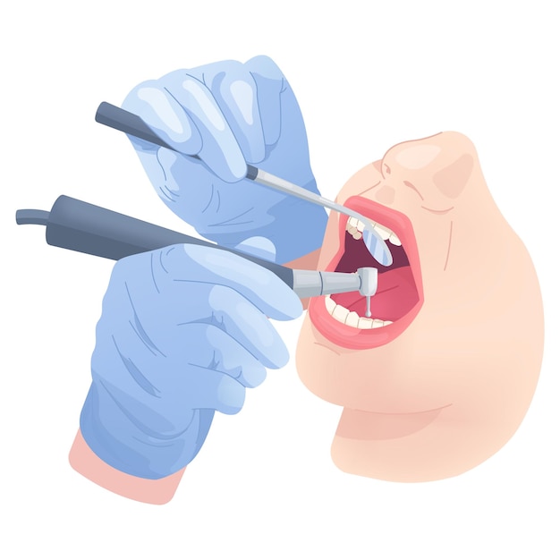Zahnarzt mit den Händen bohrt Zähne Zahnchirurgie Stomatologe mit sterilen Handschuhen mit medizinischem Werkzeug Reinigung offenen Mund Patienten Zahnmedizin Zahnbehandlung schicke Illustration