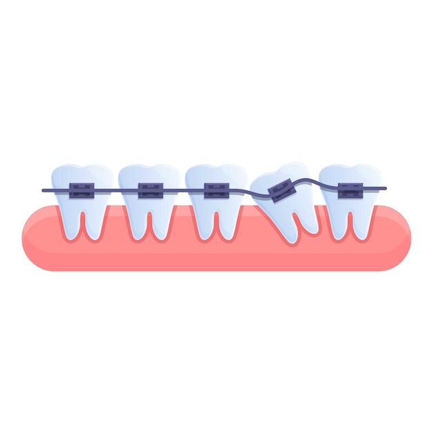 Vektor zahnspangen-schönheitssymbol cartoon des zahnspangen-schönheitsvektorsymbols für webdesign isoliert auf weißem hintergrund