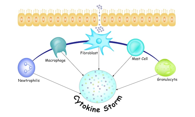 Zytokin-sturm-hyperzytokinämie, bei der das immunsystem vektor-illustration