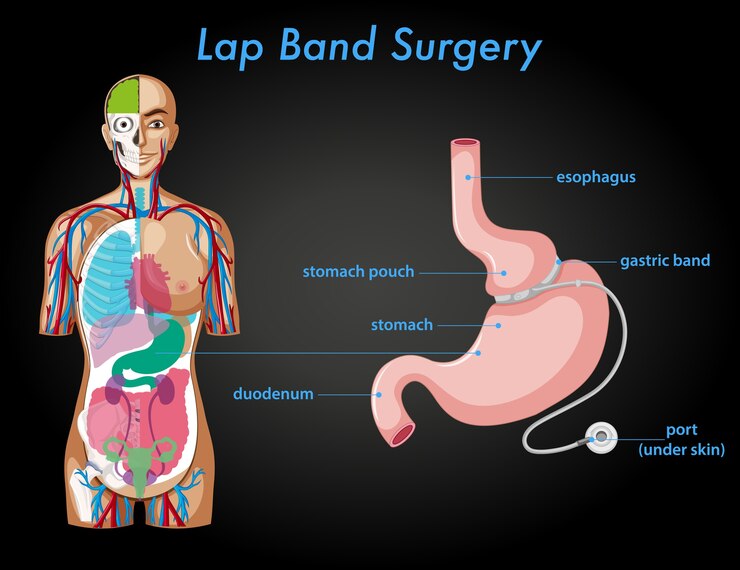 Vetor grátis anatomia da cirurgia de banda de volta