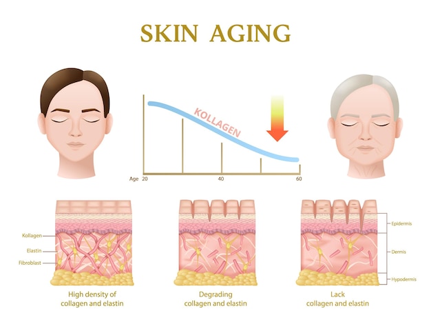Vetor grátis anatomia do processo de envelhecimento da pele das camadas durante a diminuição do nível de colágeno ilustração vetorial de infográficos realistas