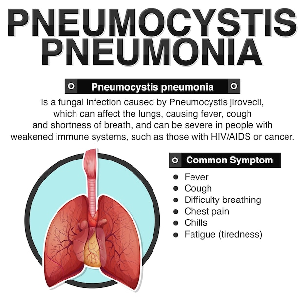 Vetor grátis cartaz informativo da pneumonia por pneumocystis