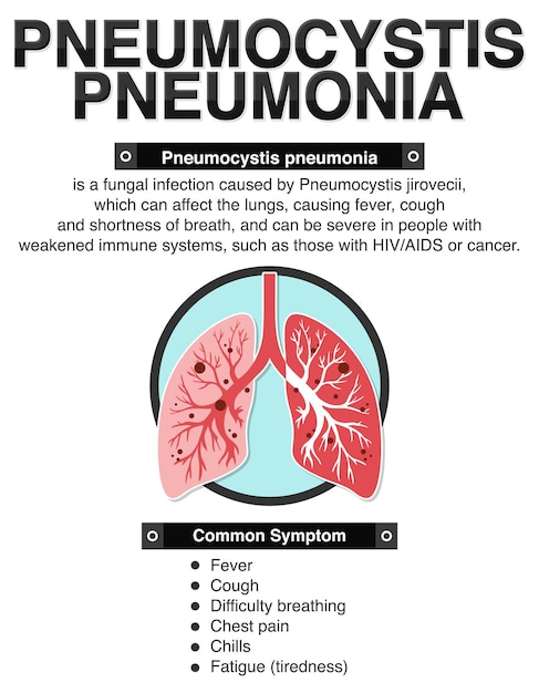 Vetor grátis cartaz informativo da pneumonia por pneumocystis