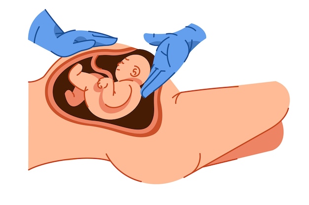 Cesariana desenhada à mão ilustrada