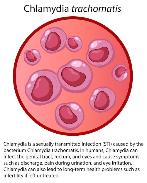 Vetor grátis chlamydia trachomatis com explicação