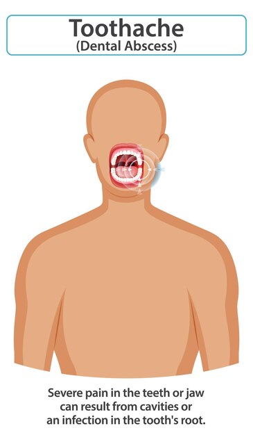 Compreender a dor de dente e o abscesso dental