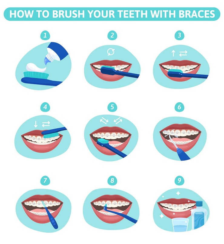 Vetor grátis conjunto plano de higiene dental de composições infográficas redondas mostrando os estágios da boca da limpeza dos dentes com aparelho ilustração do vetor
