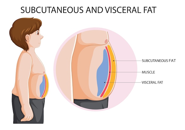 Vetor grátis diagrama de gordura subcutânea e visceral