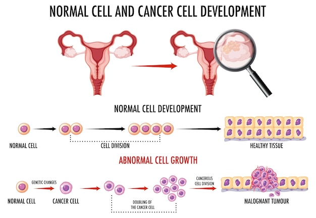 Diagrama mostrando células normais e cancerosas