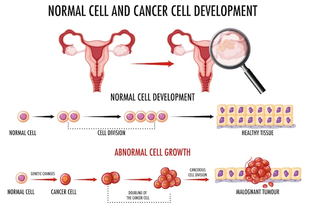 Diagrama mostrando células normais e cancerosas