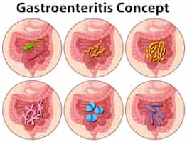 Vetor grátis diagrama mostrando ilustração do conceito de gastroenterite