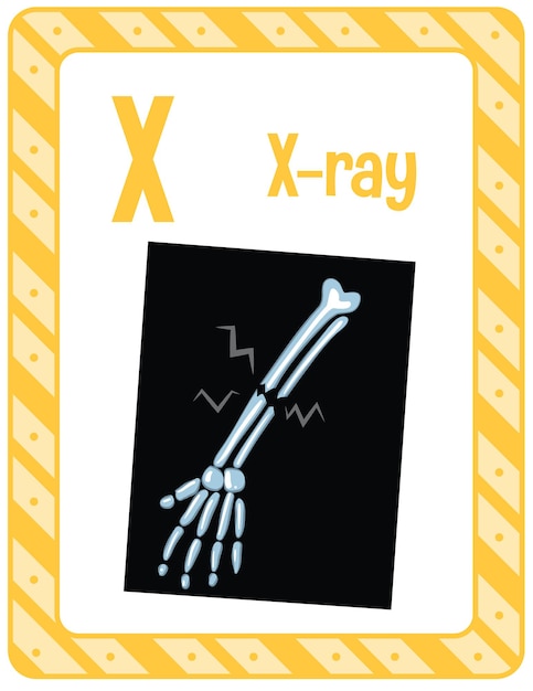Flashcard do alfabeto com a letra x para raios-x