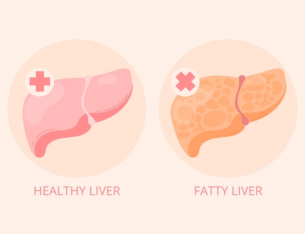 Ilustração de fígado gordo de design plano desenhado à mão