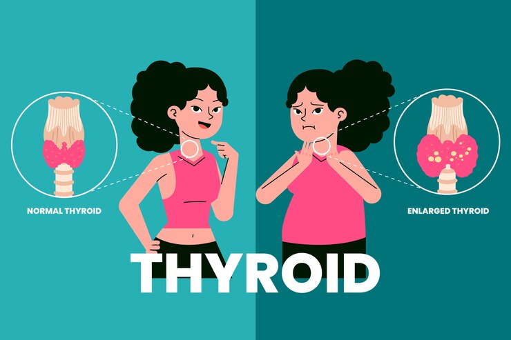 Vetor grátis ilustração de tireoide de design plano desenhado à mão