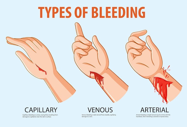 Vetor grátis ilustração de uma mão humana com diferentes tipos de sangramento