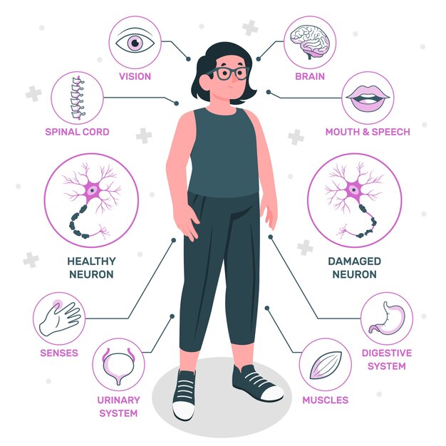 Ilustração do conceito de esclerose múltipla