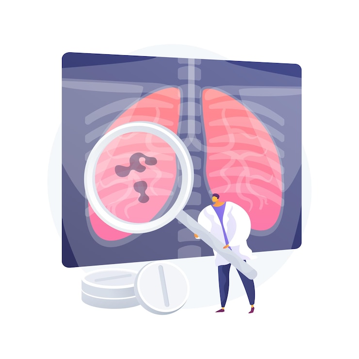 Vetor grátis ilustração em vetor conceito abstrato de infecções respiratórias inferiores. metáfora abstrata de doença infecciosa pulmonar, prevenção de pneumonia, sintomas e diagnósticos, infecção respiratória aguda inferior