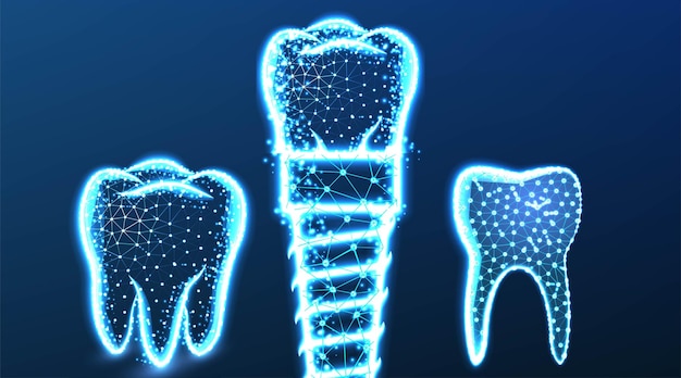 Implante dentário de dente Resumo Low Poly wireframe malha Design ilustração vetorial