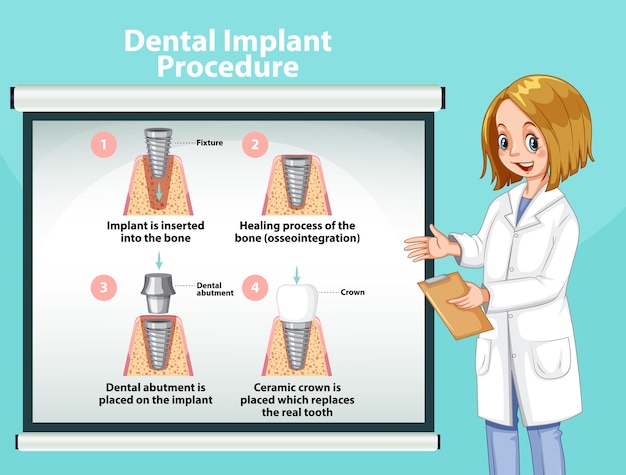 Vetor grátis infográfico de humano em procedimento de implante dentário