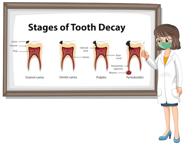 Vetor grátis infográfico de humanos nas fases de cárie dentária