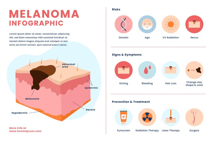 Vetor grátis infográfico de melanoma de design plano desenhado à mão
