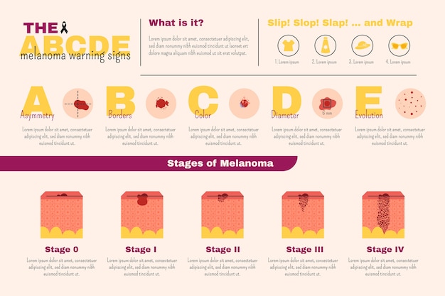 Vetor grátis infográfico de melanoma plano desenhado à mão de saúde