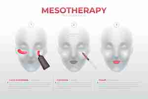 Vetor grátis infográfico de mesoterapia gradiente