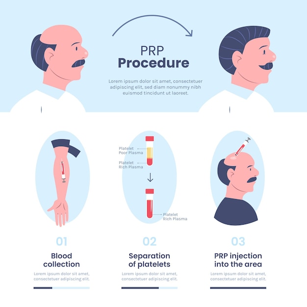 Vetor grátis infográfico de procedimentos prp desenhado à mão