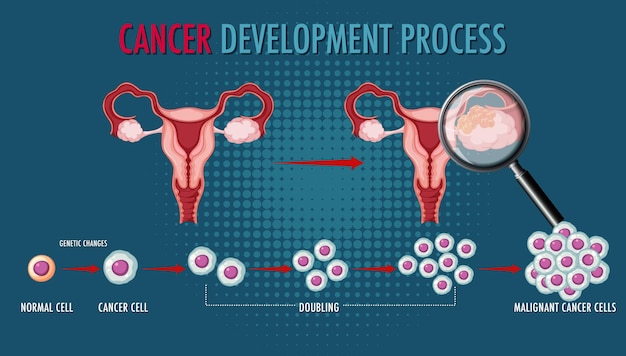 Infográfico de processo de desenvolvimento de câncer