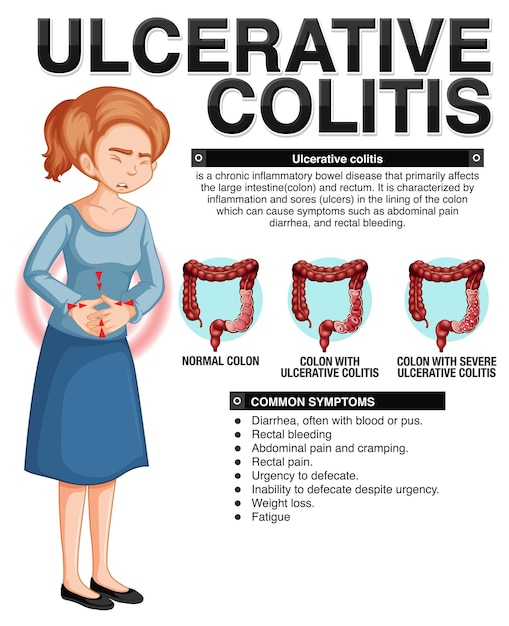 Vetor grátis infográfico de sintomas de colite ulcerosa