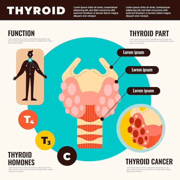 Vetor grátis infográfico de tireóide de design plano desenhado à mão