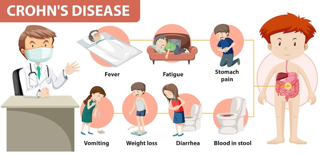 Infográfico médico da doença de Crohn