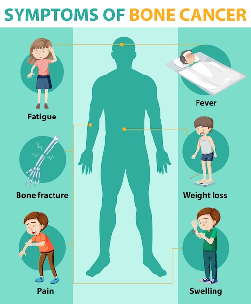 Infográfico médico de câncer ósseo