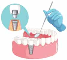 Vetor grátis mão de dentista com modelo de dentes humanos