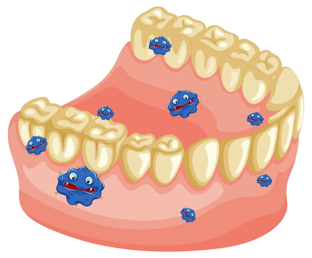 Modelo de dentes humanos amarelos com bactérias