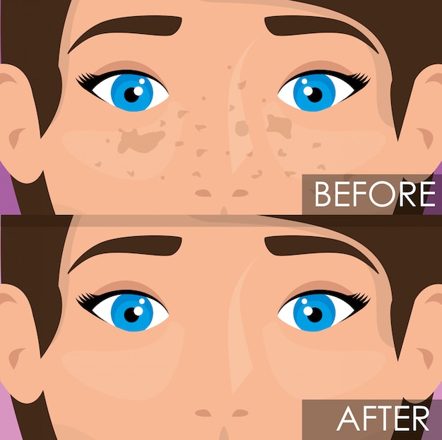 Vetor grátis mulher antes e após o tratamento da pele