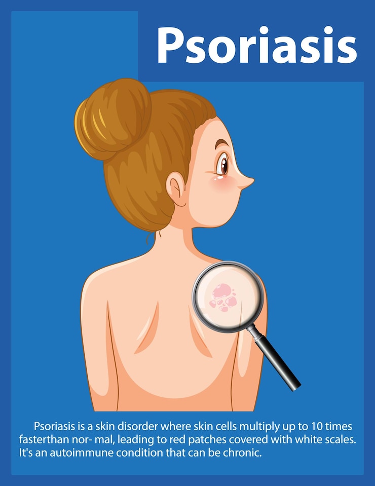 Vetor grátis mulheres com psoríase compreendem a doença de pele