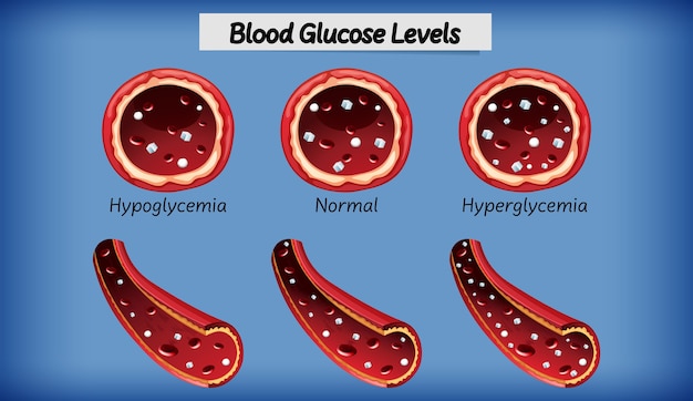 Vetor grátis nível de glicose no sangue médico